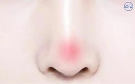 에이비성형외과 코성형 잘되는 코, 따로 있을까? 관련 이미지 5