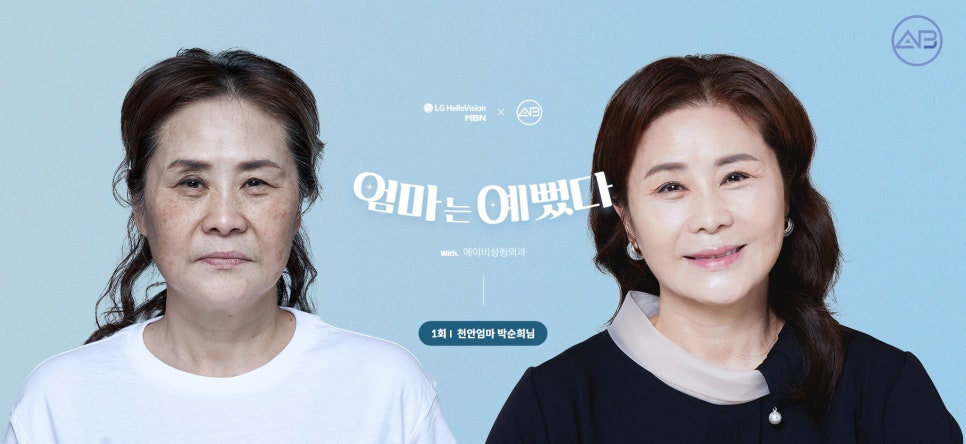 [에이비성형외과 방송출연] 관련 이미지 6