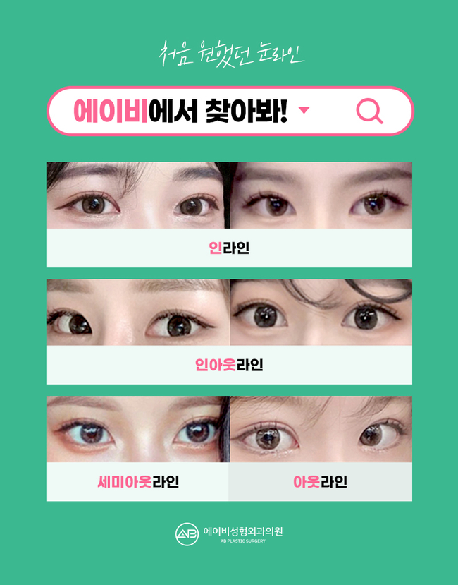 Gangnam Double Eyelid Revision Surgery Requires Caution! image 4