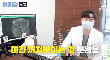 에이비성형외과 맥미걸(MAKEMEGirl) 맥미돌 코성형 상담 과정 관련 이미지 23