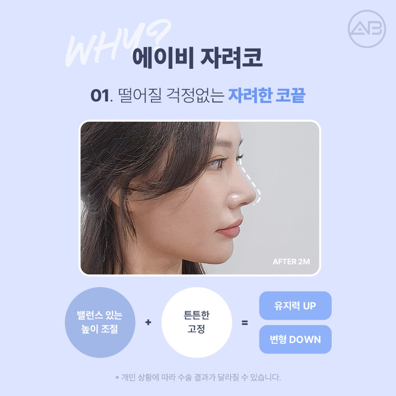 자려한코성형, 자연스럽고 세련된 코는 에이비성형외과 관련 이미지 4