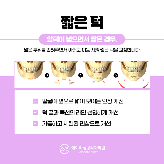 Why You Should Thoroughly Research Chin Surgery Before Having It image 6