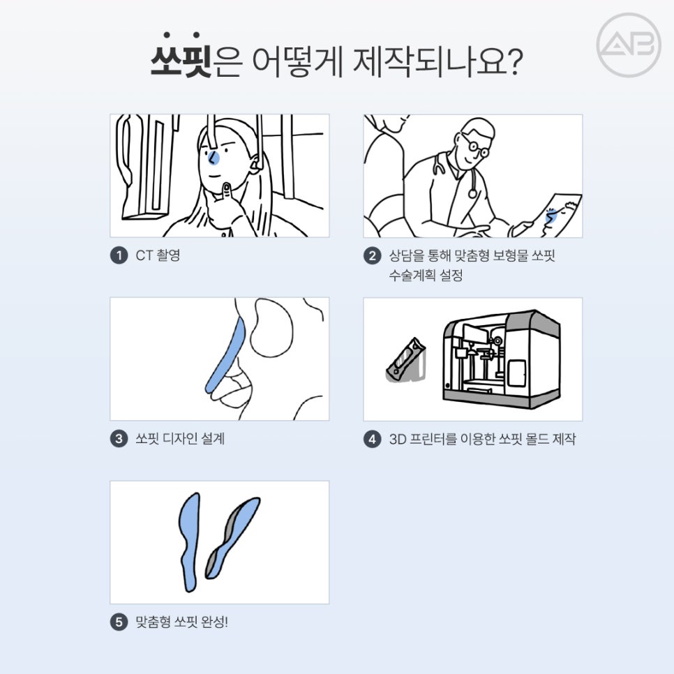 에이비성형외과 쏘핏 (SOFIT) 3D 코성형보형물 비대칭 매부리 개선 관련 이미지 9