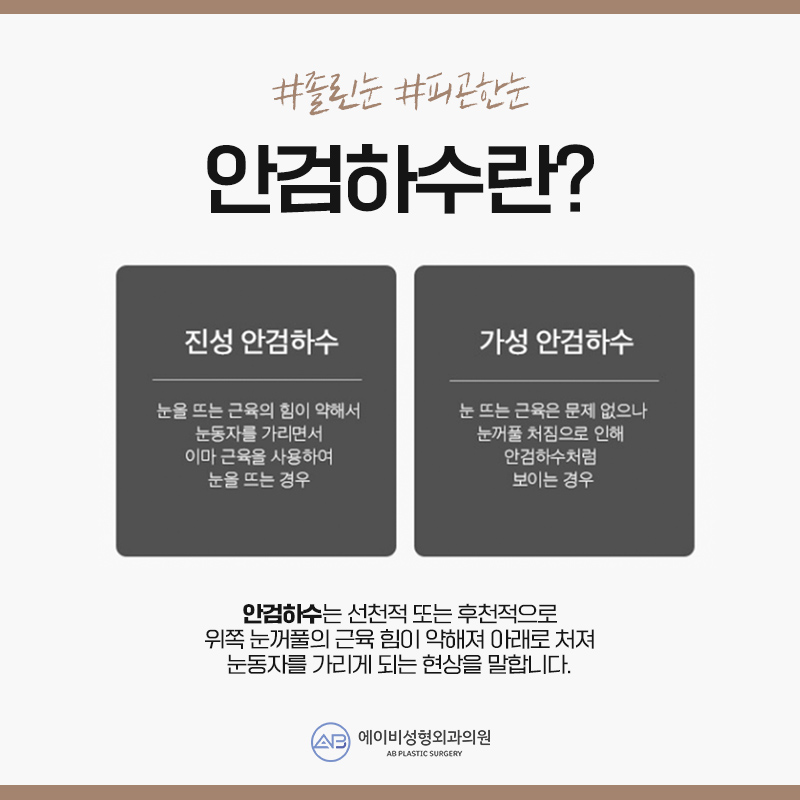 안검하수수술 부담없이 관련 이미지 3
