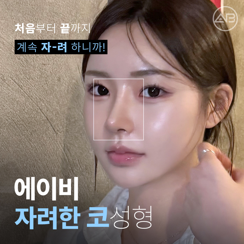에이비성형외과 자려한코성형 비주라인개선 후기 관련 이미지 9