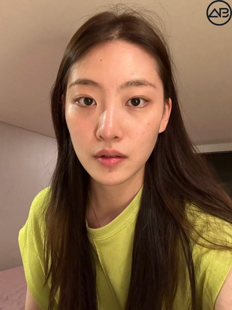 AB성형외과 예쁜애 옆에 예쁜애 후기 모음집 관련 이미지 1