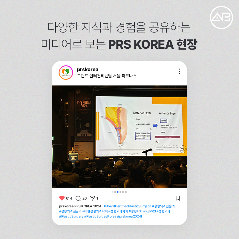 PRS KOREA 2024 : 에이비성형외과의 발표 내용과 성과 관련 이미지 6