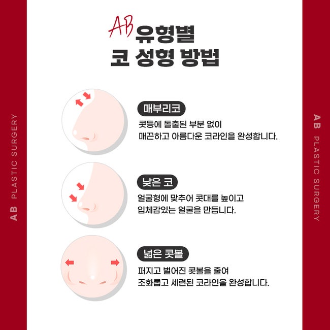 코수술후기 많은 에이비성형외과 관련 이미지 3