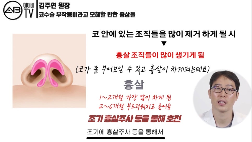 #에이비성형외과#에이비TV#코성형#부작용아닌증상 관련 이미지 7