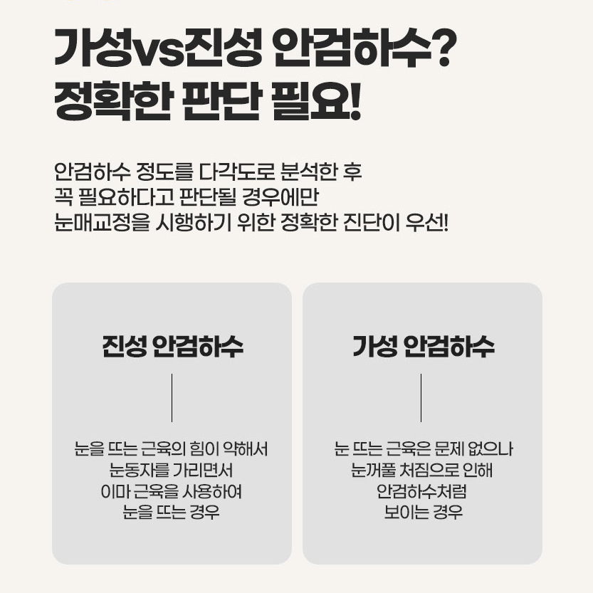 [칼럼] 안검하수가 대체 뭐죠 ? 관련 이미지 2