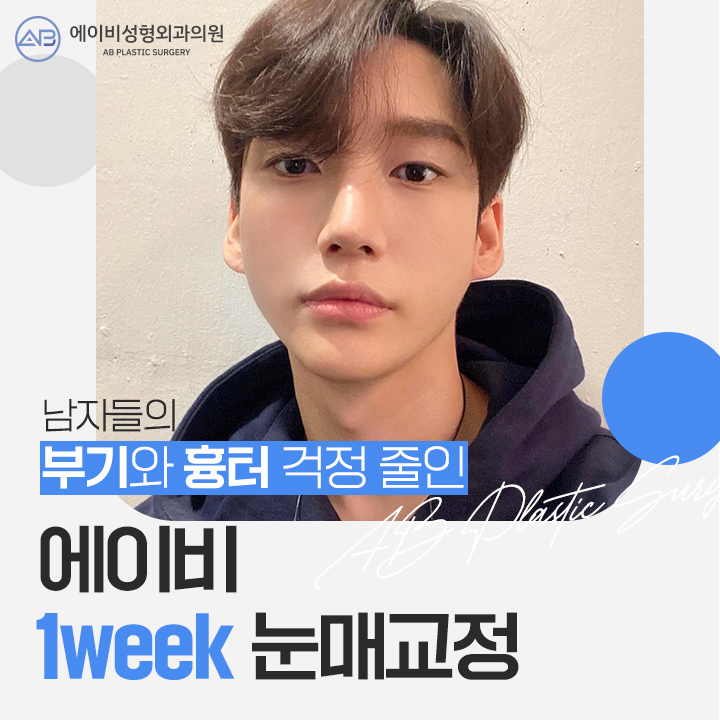 남자눈성형잘하는곳 에이비 라며? 관련 이미지 1