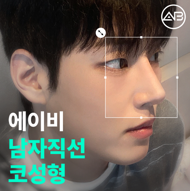 남자직선코성형 왜 에이비성형외과일까? 관련 이미지 1