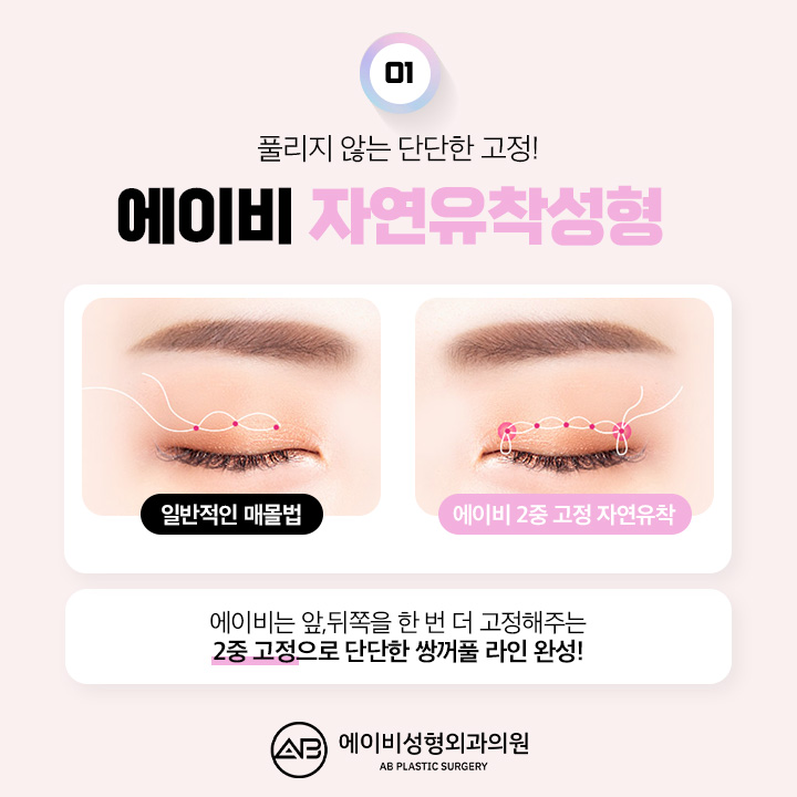 쌍꺼풀수술전후 새로운 결과를 관련 이미지 2