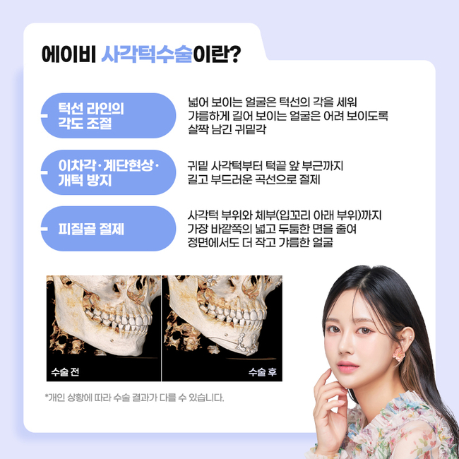 AB Plastic Surgery Clinic with Three Types of Facial Contouring, Different in Detail image 5