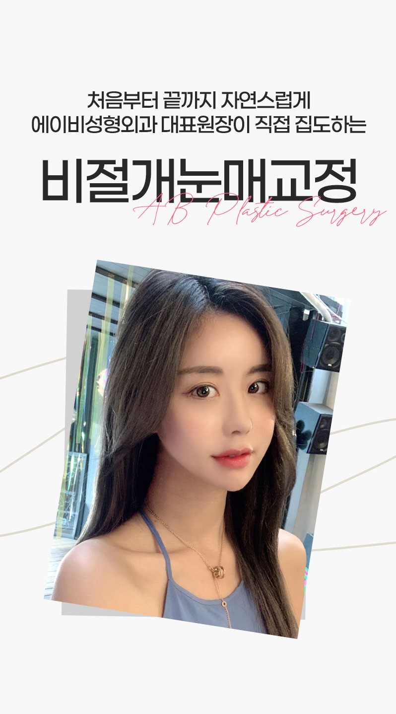 AB성형외과와 눈매교정수술전후 비교해보세요! 관련 이미지 3