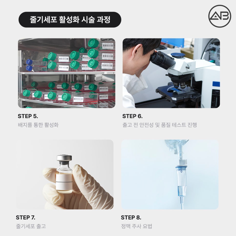 에이비성형외과 활성화줄기세포 안티에이징 안전성 종류 재생 효과 관련 이미지 4