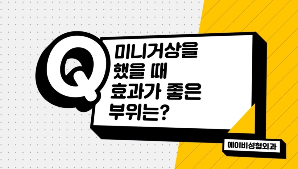 #에이비성형외과#에이비TV#안면거상#미니거상 관련 이미지 2