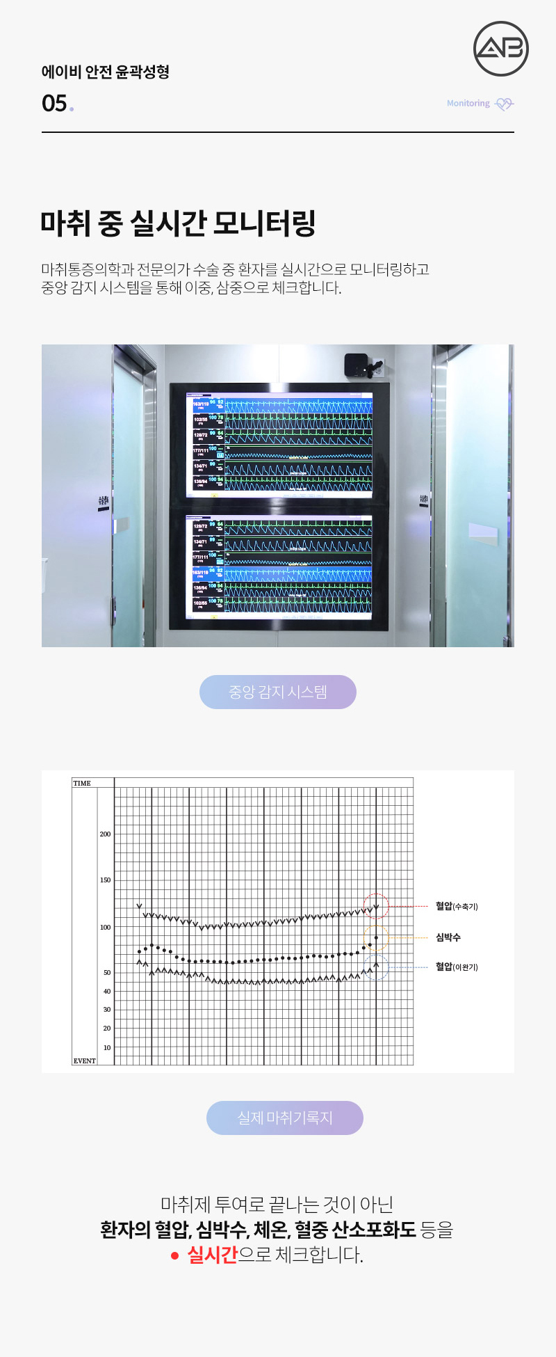 AB Plastic Surgery Facial Contouring Safety System image 6