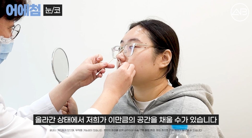 에이비성형외과 맥미걸(MAKEMEGirl) 맥미돌 코성형 상담 과정 관련 이미지 5