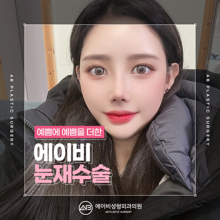 눈재수술유명한곳 하면 에이비성형외과 아닐까 관련 이미지 1
