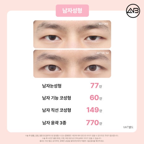 에이비성형외과 설렘 가득 봄 한정 49% 할인 이벤트 관련 이미지 12