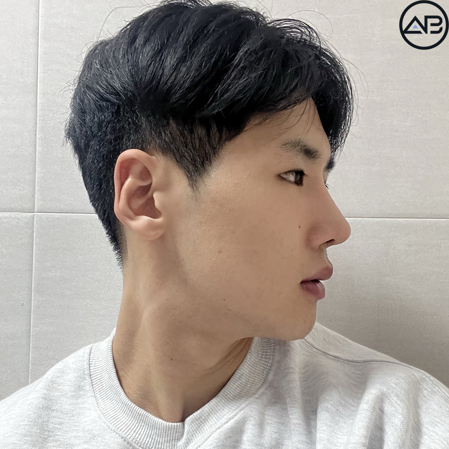 AB Plastic Surgery, MAKEmiNamn Broadcast Afterlife Update_방구석내남자 image 8