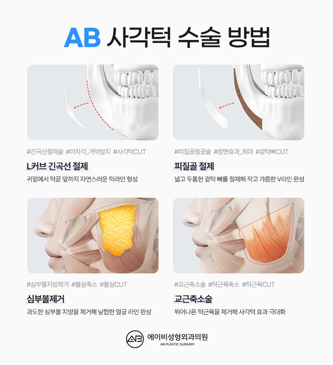 귀뒤사각턱수술 왜 에이비성형외과일까? 관련 이미지 3