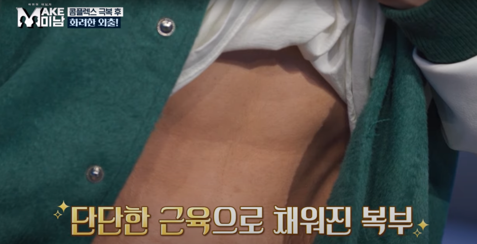 [AB Plastic Surgery Featured on Broadcast] LG HelloVision & KBSjoy image 12