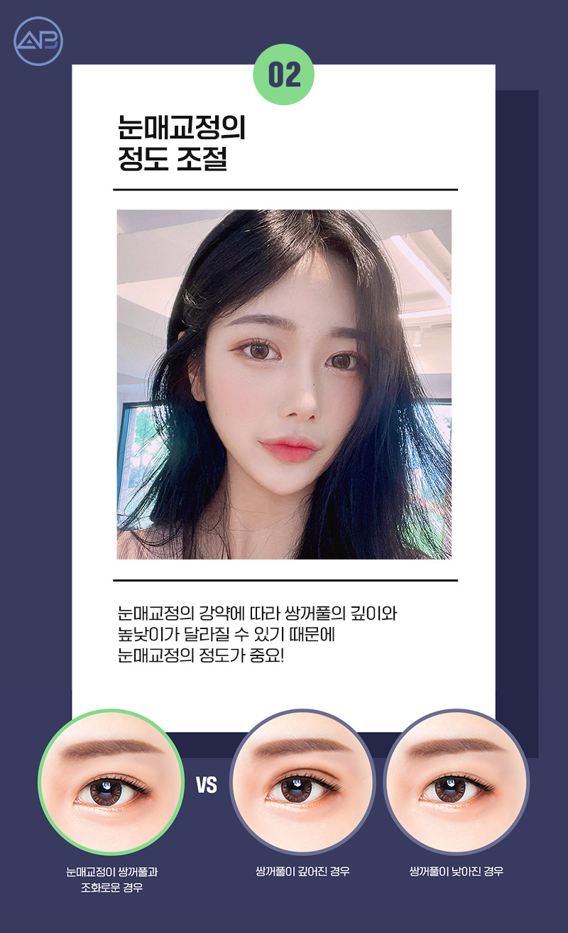 눈매교정수술후기 에이비성형외과에서 확인해 관련 이미지 4