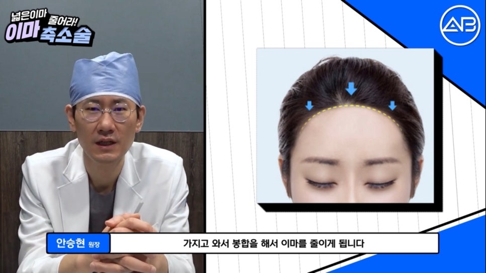 #에이비성형외과#에이비TV#이마축소술 관련 이미지 7