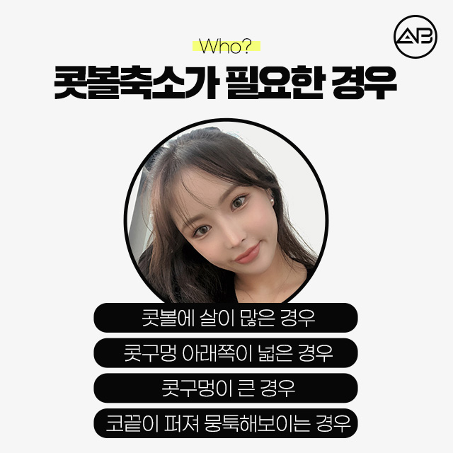 콧볼축소수술 코뚠뚠이의 해결책 관련 이미지 3