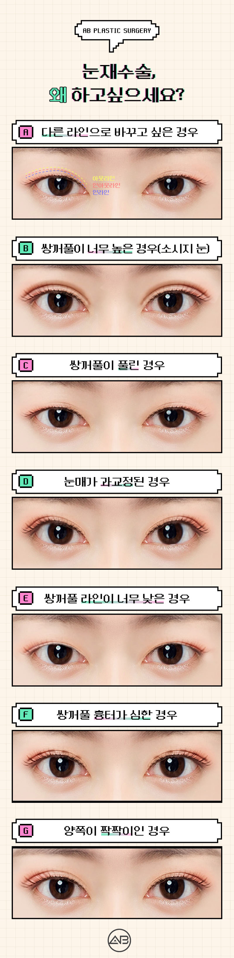 Still 고민ing About Double Eyelid Revision Surgery Cost? image 3
