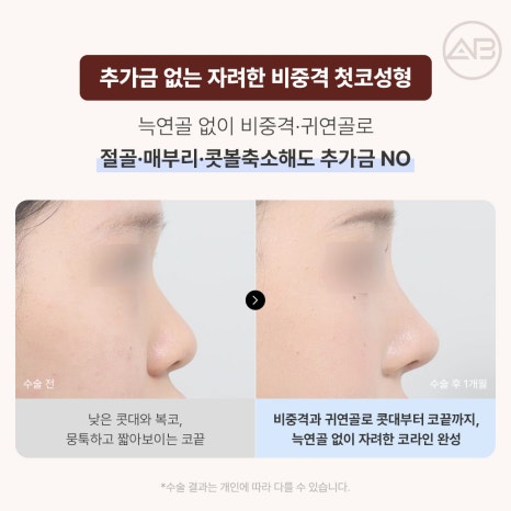 에이비성형외과 10월 자려한 가을이벤트 관련 이미지 4