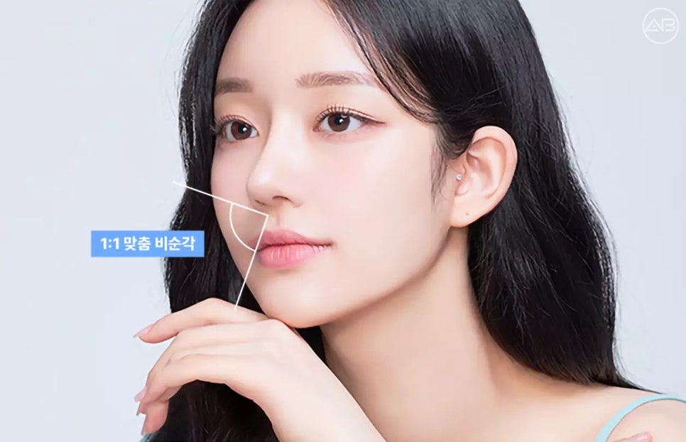 에이비성형외과 자려한 비주라인 코성형수술 관련 이미지 7