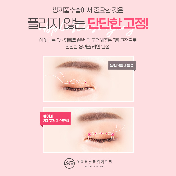 자연유착쌍꺼풀 내가 원하던 대로 관련 이미지 2