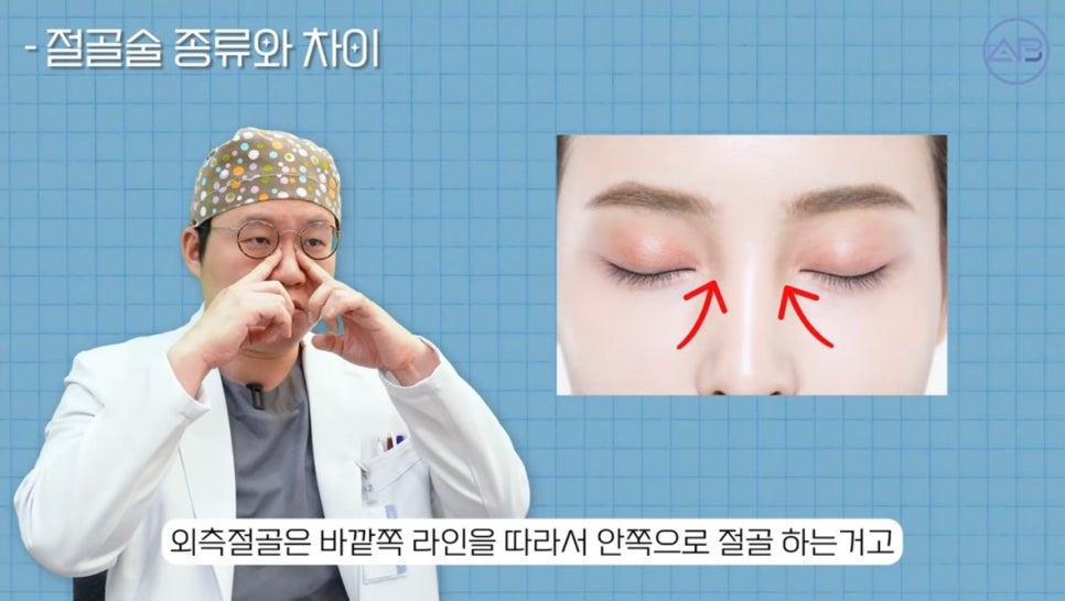 #에이비성형외과#에이비tv#코성형#코성형용어 관련 이미지 6