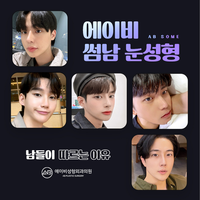 에이비성형외과 썸남눈성형 이게 뭔데? 관련 이미지 9