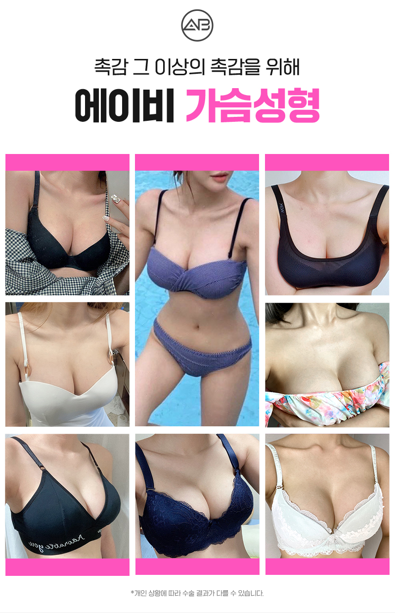 가슴성형전후 비교할때 이것도 참고 관련 이미지 6