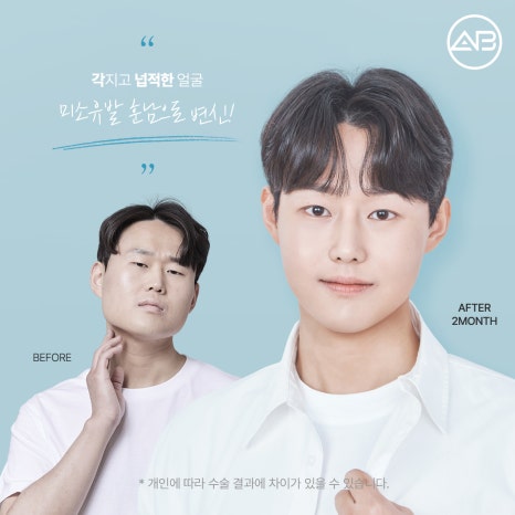 에이비성형외과 맥미남(MAKE미남)9회 - 민원유발내남자 짧은코수술, 매부리코수술 알아보기! 관련 이미지 9