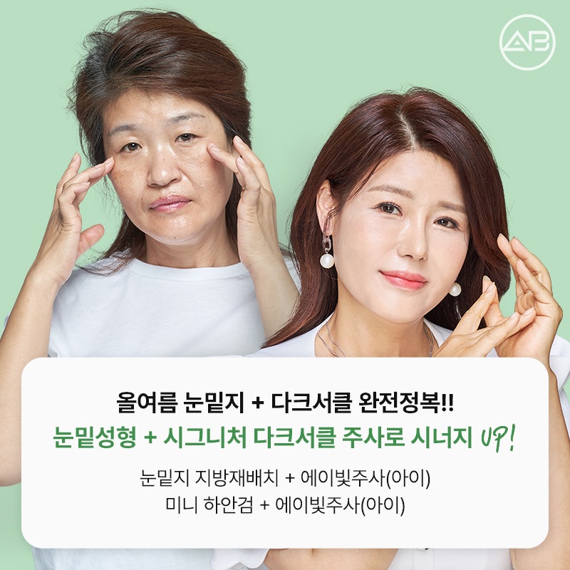 에이비성형외과 눈밑지방재배치 하안검 수술 전후 다크서클 개선과 에이빛주사 이벤트 관련 이미지 2