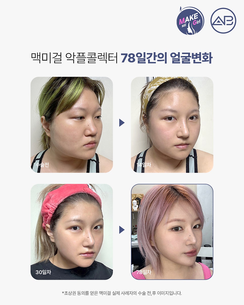 AB Plastic Surgery Clinic image 6