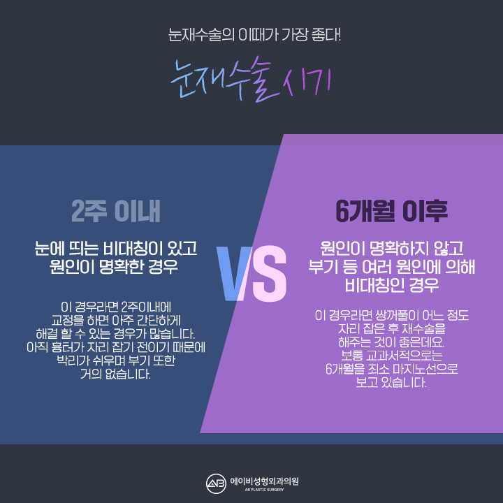 눈재수술비용 얼마인지 궁금해? 관련 이미지 4