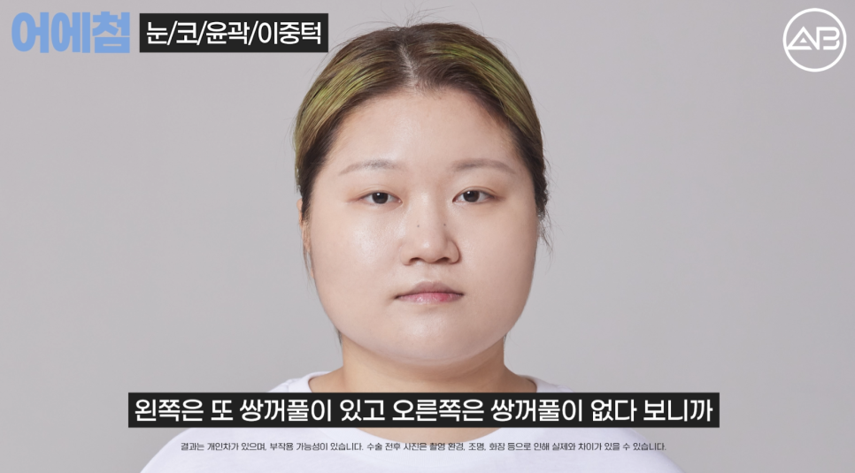 에이비성형외과 관련 이미지 10