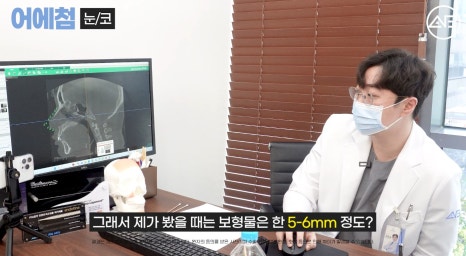 에이비성형외과 맥미걸(MAKEMEGirl) 맥미돌 코성형 상담 과정 관련 이미지 22