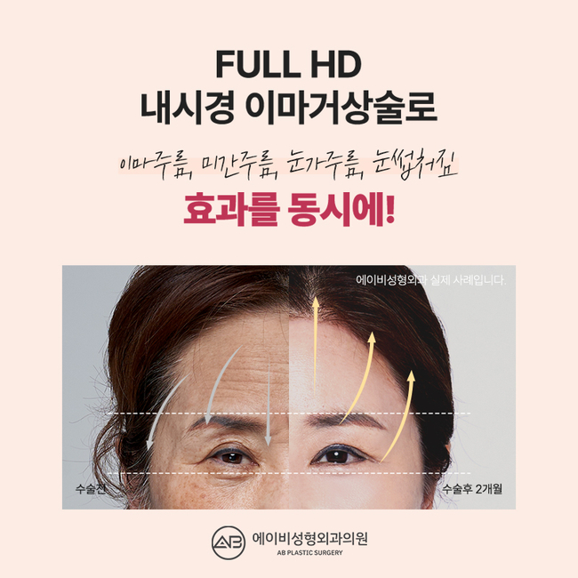 이마거상술가격 합리적으로 신중하게 선택하는 방법 관련 이미지 2