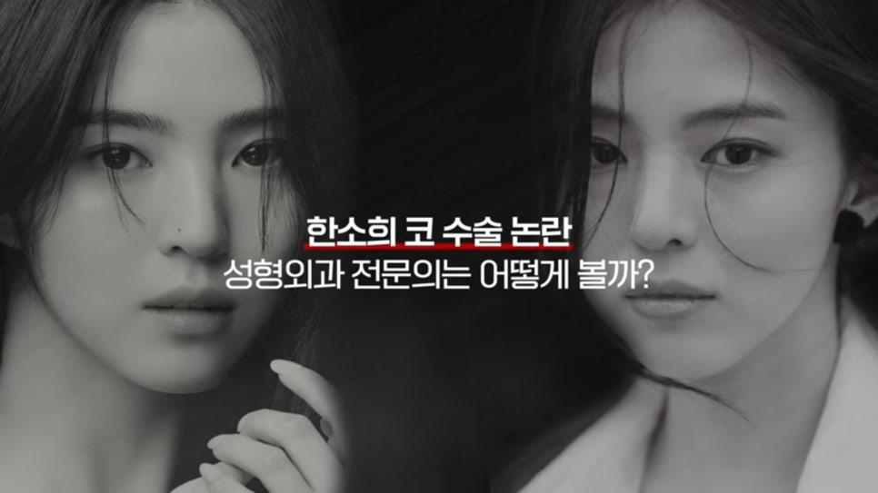 #AB Plastic Surgery #AB TV #Rhinoplasty #Rhinoplasty for Rhinitis image 2