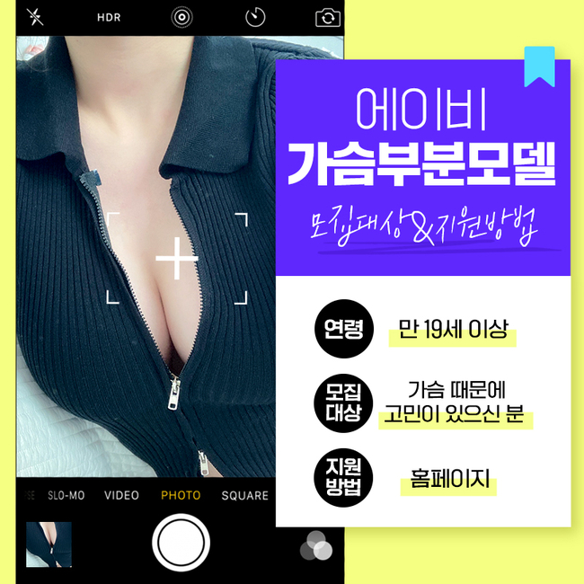 에이비성형외과 가슴리얼모델 모집안내 관련 이미지 2