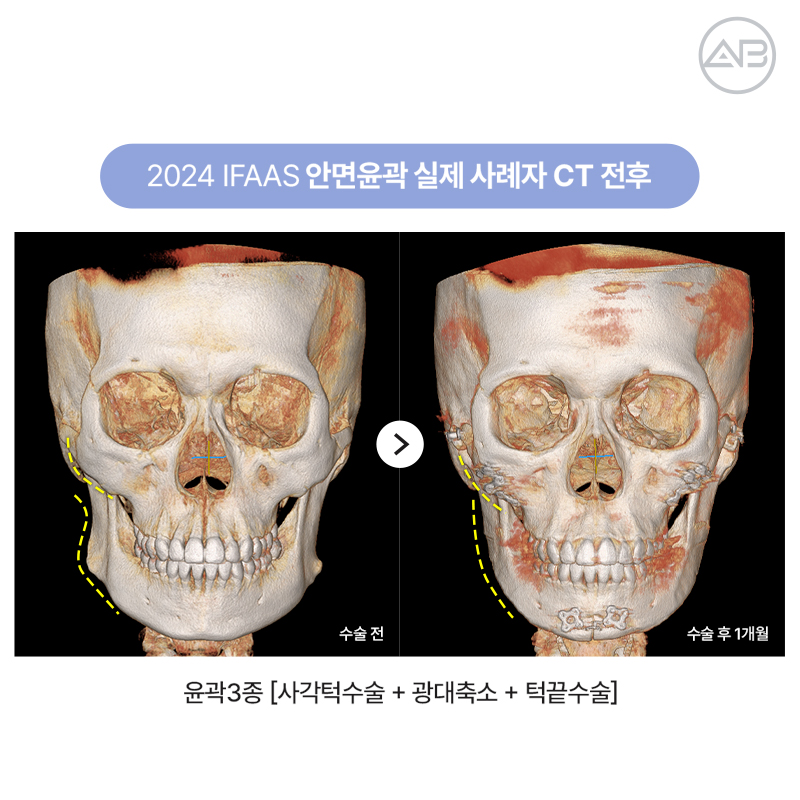AB Plastic Surgery Hosts the 2026 Facial Contouring Surgery IFAAS Symposium for the Third Consecutive Year image 4