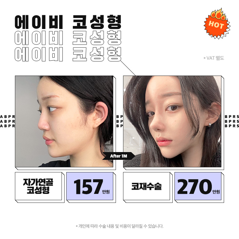 에이비성형외과 확장이전 이벤트 안내 관련 이미지 3