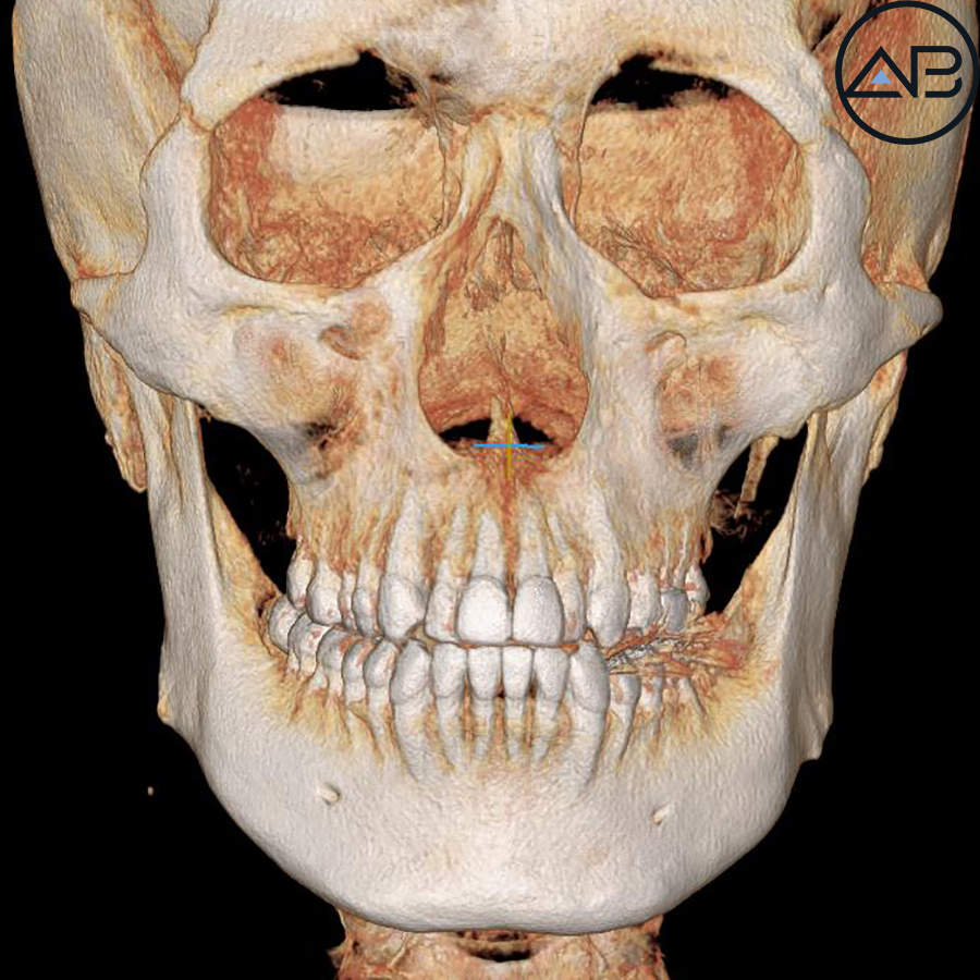 AB Plastic Surgery, MAKEmiNamn Broadcast Afterlife Update_방구석내남자 image 11
